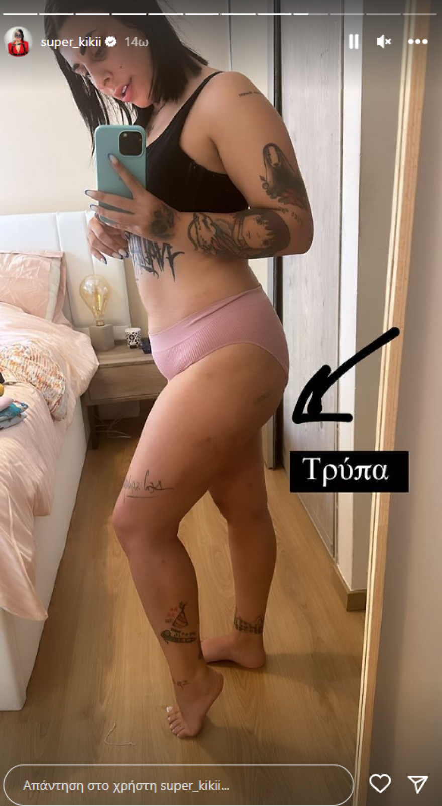 Super Κική: Δείχνει το σώμα της μετά τη λιποαναρρόφηση - Δείτε φωτογραφίες