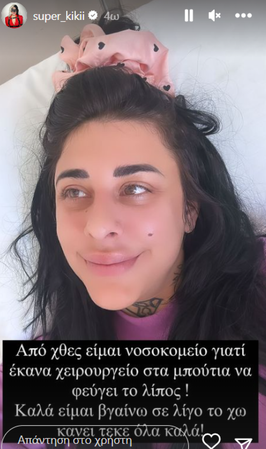 Super Κική: Δείχνει το σώμα της μετά τη λιποαναρρόφηση - Δείτε φωτογραφίες