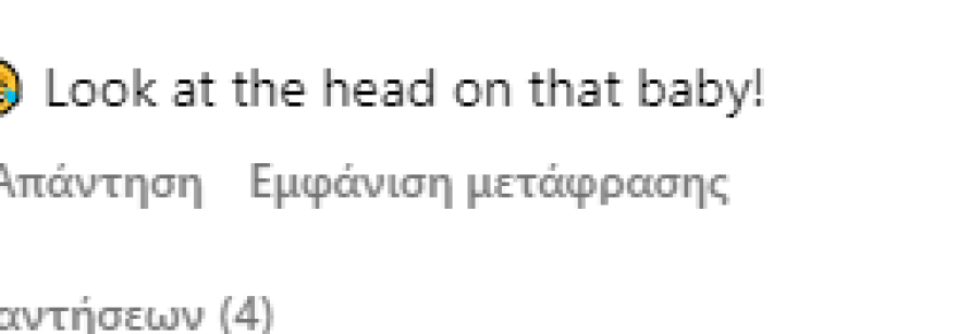 Πάρις Χίλτον: Κοροϊδεύουν το μωρό της στο Instagram για το κεφάλι του