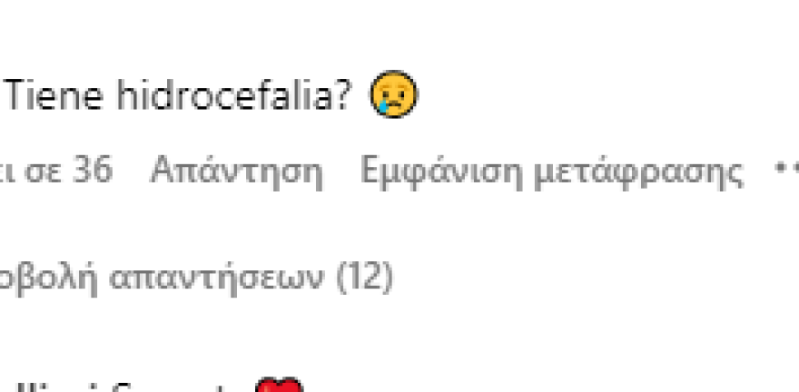 Πάρις Χίλτον: Κοροϊδεύουν το μωρό της στο Instagram για το κεφάλι του