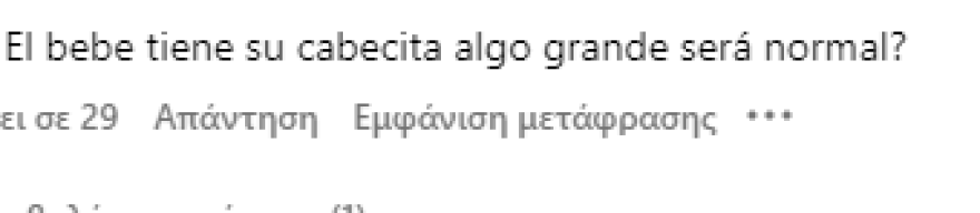 Πάρις Χίλτον: Κοροϊδεύουν το μωρό της στο Instagram για το κεφάλι του