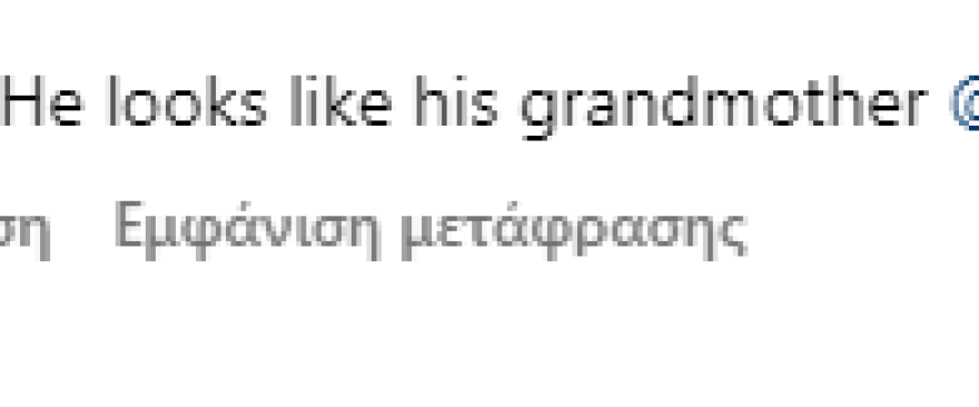 Πάρις Χίλτον: Κοροϊδεύουν το μωρό της στο Instagram για το κεφάλι του