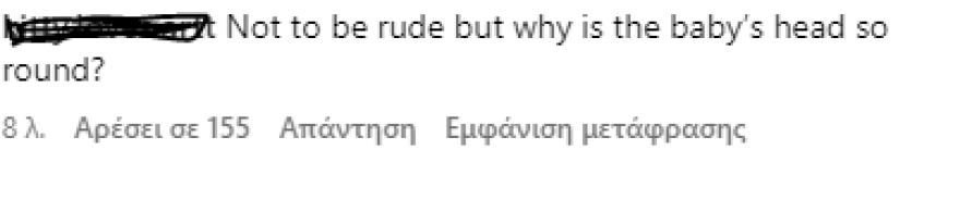 Πάρις Χίλτον: Κοροϊδεύουν το μωρό της στο Instagram για το κεφάλι του