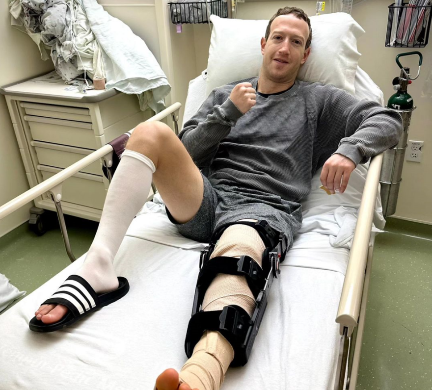 Μαρκ Ζούκερμπεργκ: Στο χειρουργείο μετά από προπόνηση που έκανε για αγώνες MMA