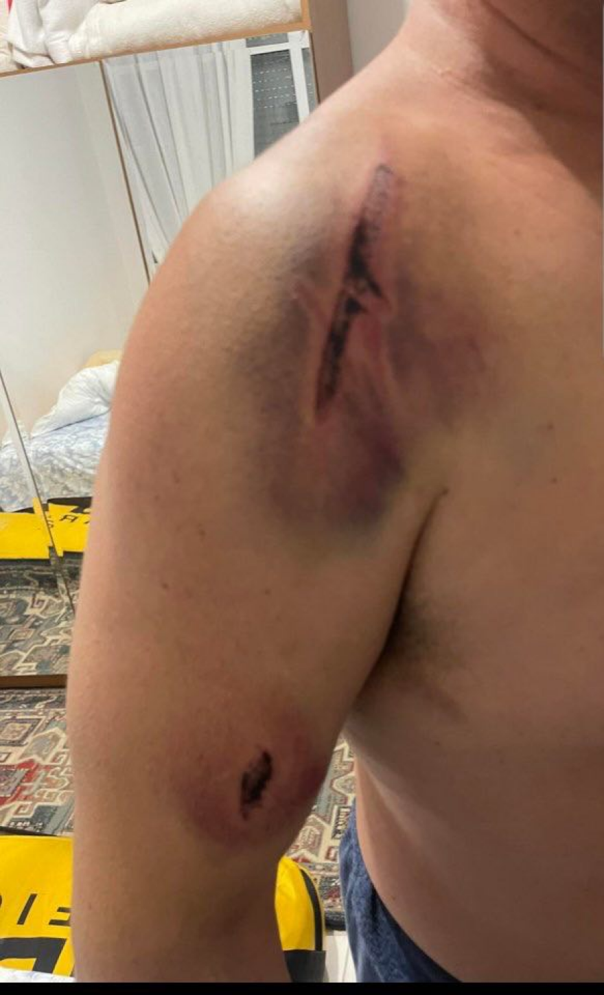 Θεσσαλονίκη: Έσπασαν με κλωτσιά το τζάμι της καμπίνας οδηγού του ΟΑΣΘ όταν τους έκανε παρατήρηση επειδή άναψαν τσιγάρο