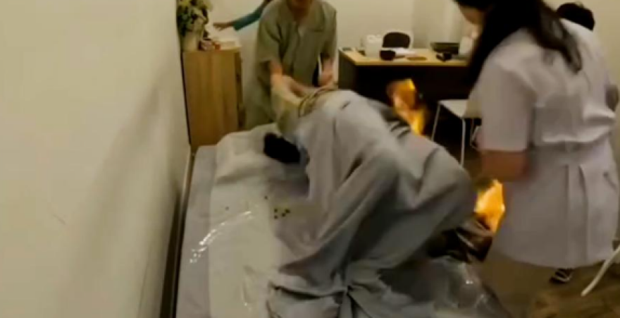 Ταϊλάνδη: Μοντέλο έπιασε φωτιά κατά τη διάρκεια «εναλλακτικής θεραπείας» για το στομάχι  - Σοκαριστικό βίντεο