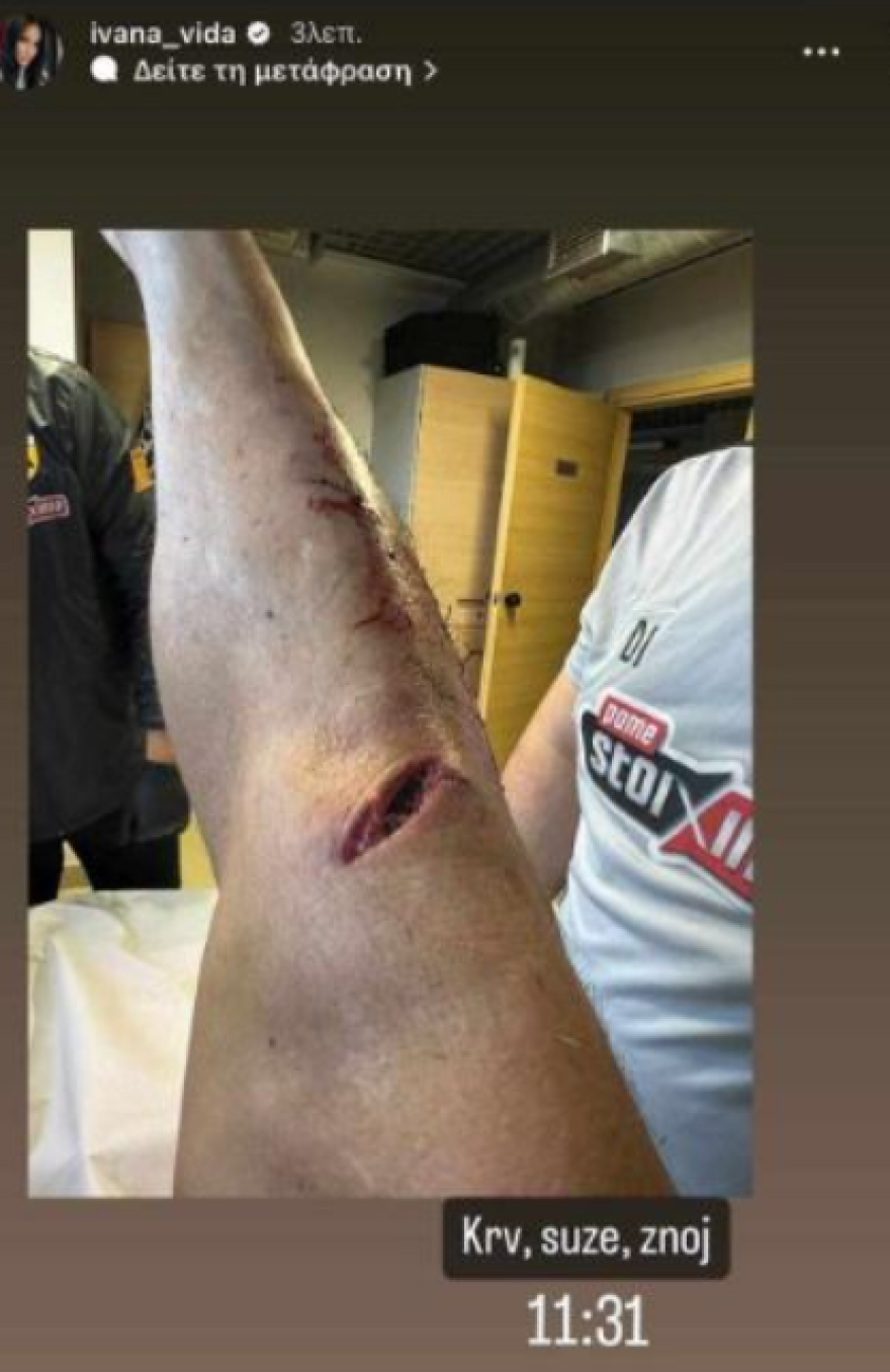 Σόκαρε την ΑΕΚ ο Βίντα - Θλαστικό τραύμα και ράμματα στο γόνατο στην τελευταία προπόνηση της Ένωσης - Φωτογραφία 