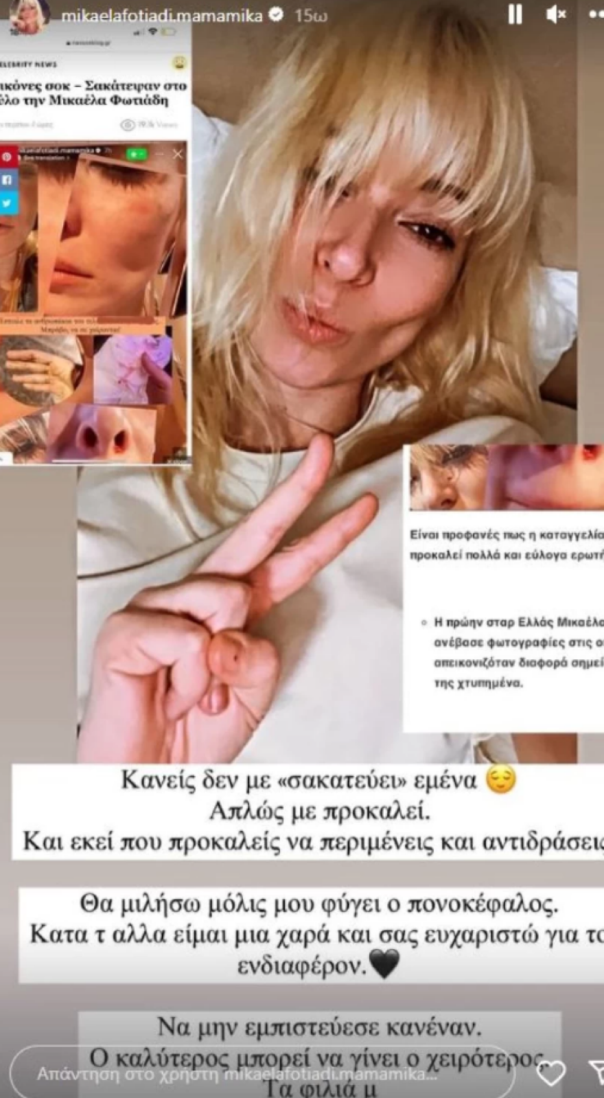 Μικαέλα Φωτιάδη: Ξυλοκόπησαν το μοντέλο - Δημοσίευσε φωτογραφίες της με αίματα