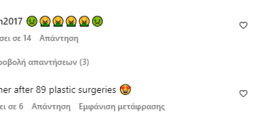 Κιμ Καρντάσιαν: Πόζαρε με μίνι και μαγιό - Της γράφουν «ντύνεσαι σαν έφηβη ενώ μοιάζεις με 50»