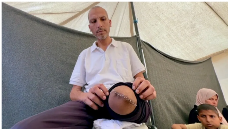 Σοκαριστικές καταγγελίες για ισραηλινό νοσοκομείο: Παλαιστίνιοι δεμένοι με χειροπέδες και με πάνες στα κρεβάτια τους