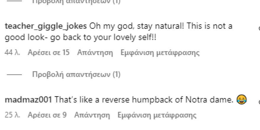 Κέιτι Πράις: Δείχνει το στήθος της μετά τη 17η αυξητική επέμβαση - Είναι γελοίο, σχολιάζει το Instagram