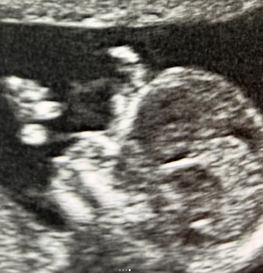 Ευρυδίκη Παπαδοπούλου: Φωτογραφίες από τις βόλτες της στα Ματογιάννια στον 6ο μήνα της εγκυμοσύνης της