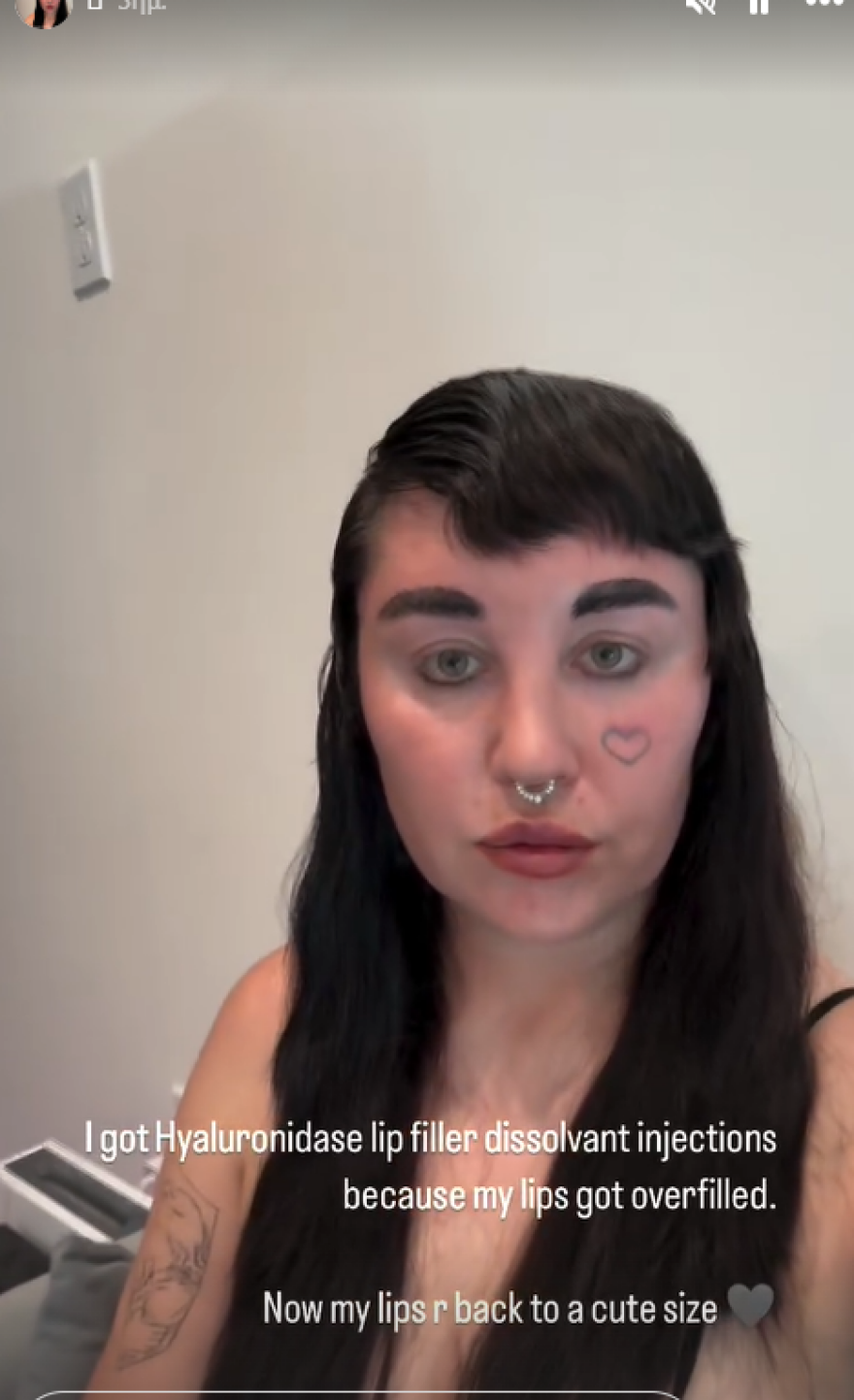 Αμάντα Μπάινς: Τρόμαξαν οι φαν της με την αλλαγή στην εμφάνισή της