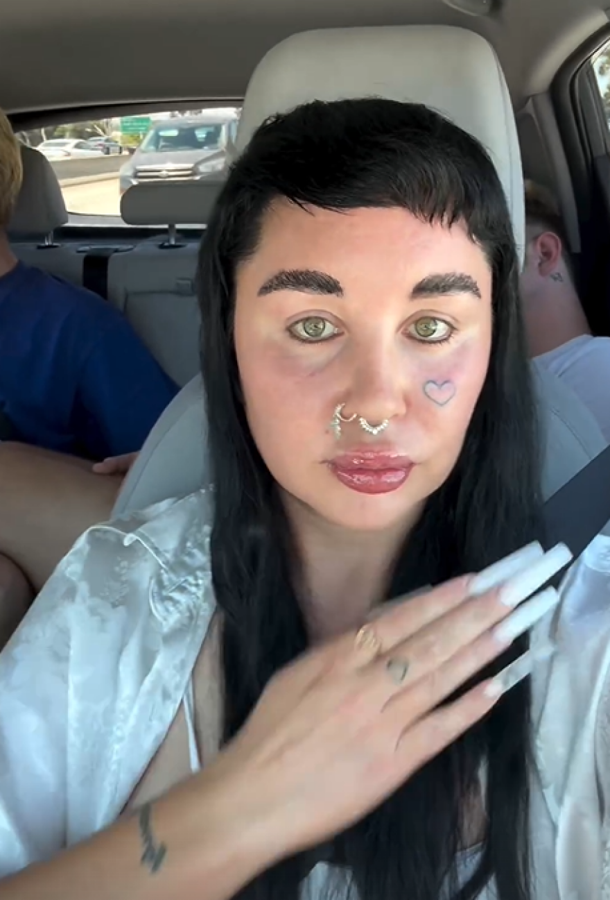 Αμάντα Μπάινς: Τρόμαξαν οι φαν της με την αλλαγή στην εμφάνισή της