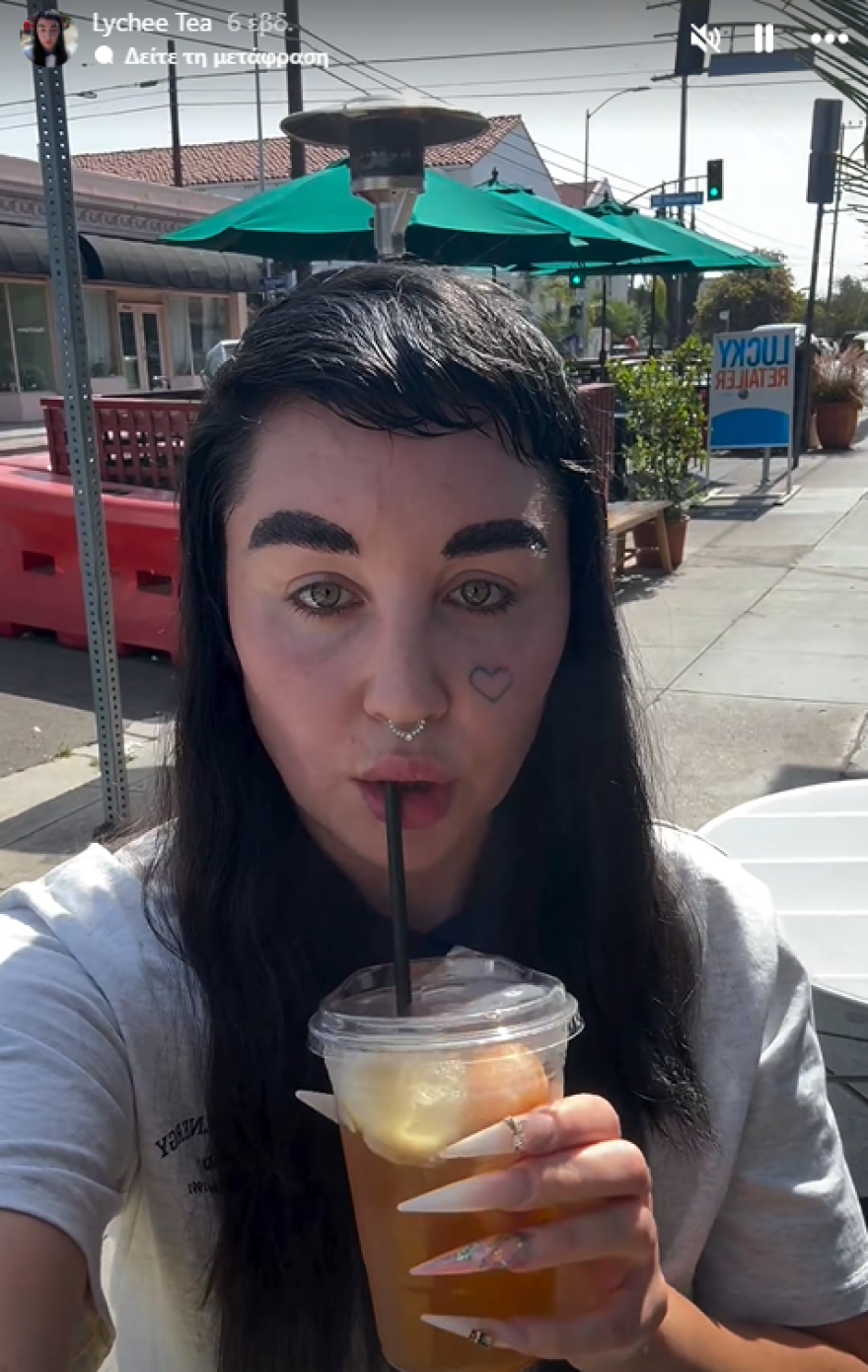 Αμάντα Μπάινς: Τρόμαξαν οι φαν της με την αλλαγή στην εμφάνισή της