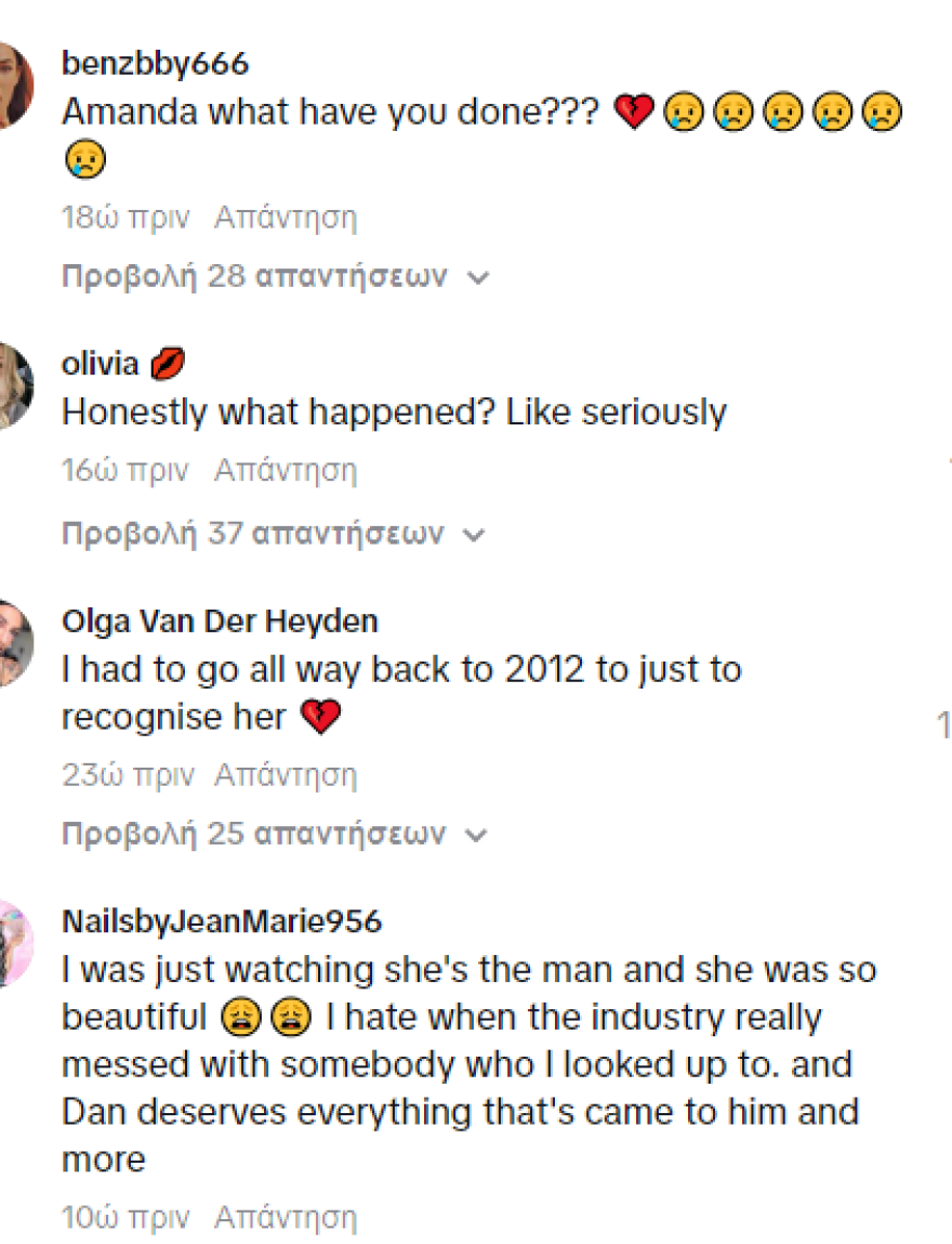 Αμάντα Μπάινς: Τρόμαξαν οι φαν της με την αλλαγή στην εμφάνισή της