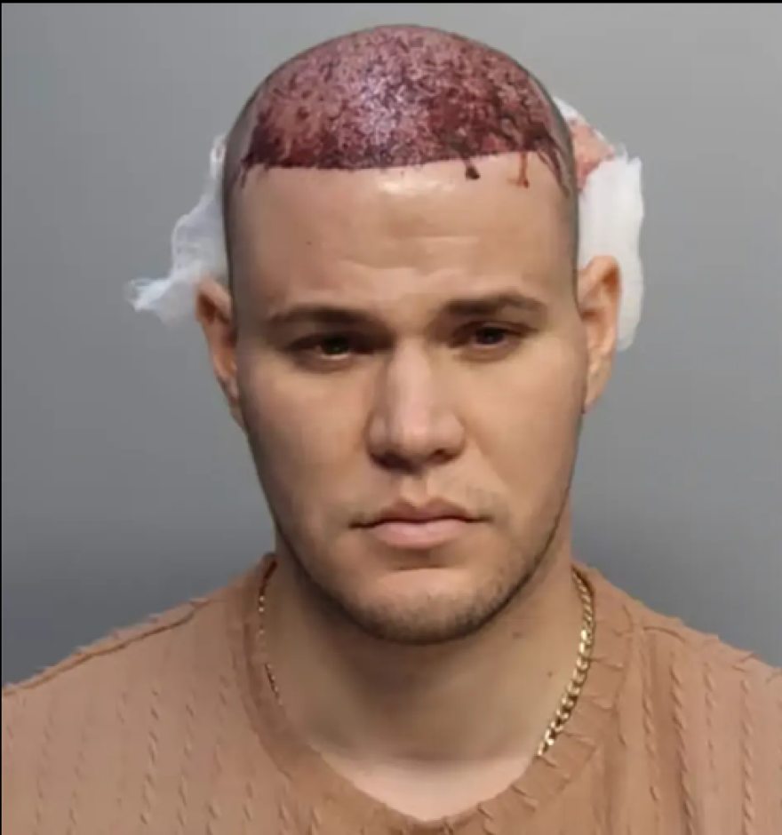 Άνδρας με ματωμένο κεφάλι προκάλεσε αναστάτωση σε αεροσκάφος της American Airlines και συνελήφθη - Δείτε φωτογραφίες