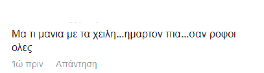 Ιωάννα Τούνη: Ενθουσιασμένη με δωροεπιταγή από τις φίλες της για να βάλει υαλουρονικό στα χείλη