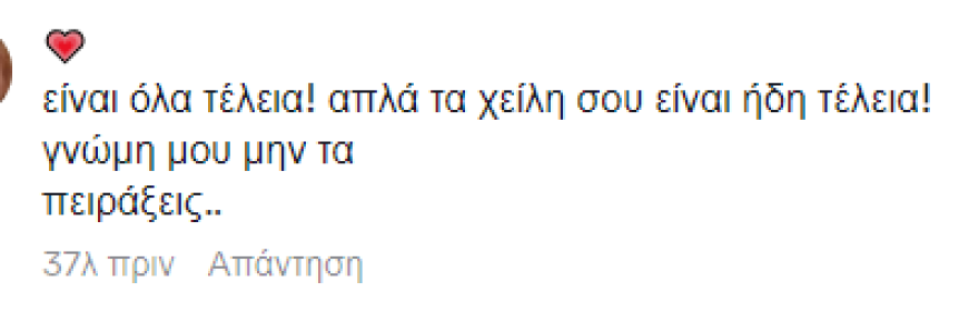 Ιωάννα Τούνη: Ενθουσιασμένη με δωροεπιταγή από τις φίλες της για να βάλει υαλουρονικό στα χείλη