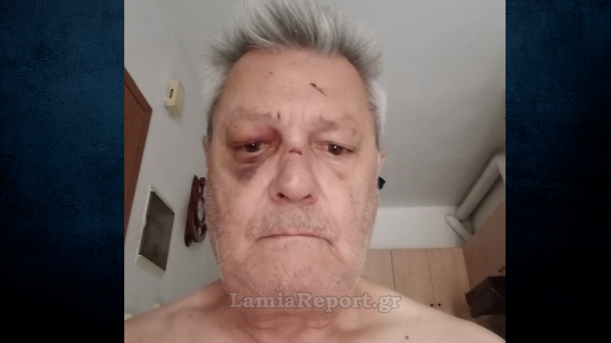Λαμία: 65χρονος έπεσε θύμα ληστείας και ξυλοδαρμού από έναν παλιό γειτονά του