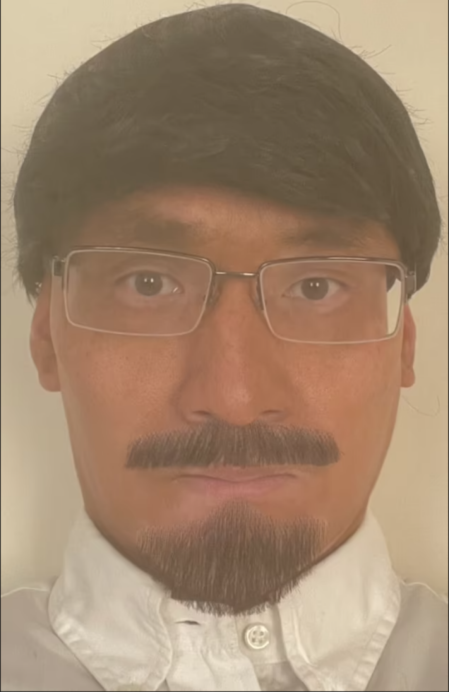 Βρετανία: Γιατρός μεταμφιέστηκε σε νοσοκόμο για να σκοτώσει με δήθεν εμβόλιο Covid τον σύντροφο της μητέρας του