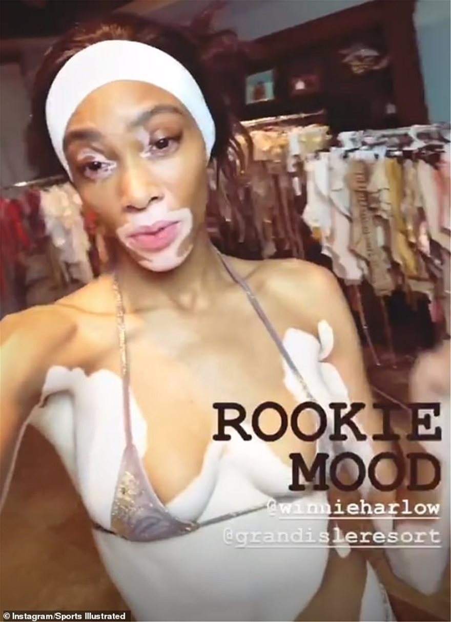 Winnie Harlow Nude Pics