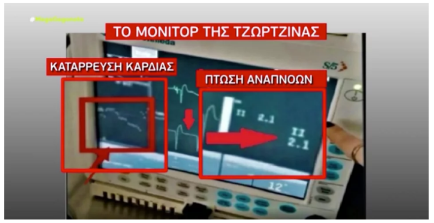 monitor-2
