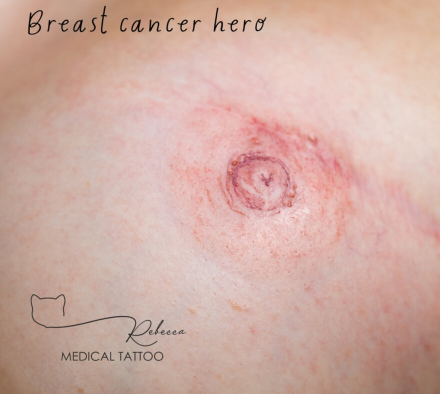 Paramedical tattoo artist «ζωγραφίζει» το χαμόγελο σε γυναίκες που έχουν υποβληθεί σε μαστεκτομή