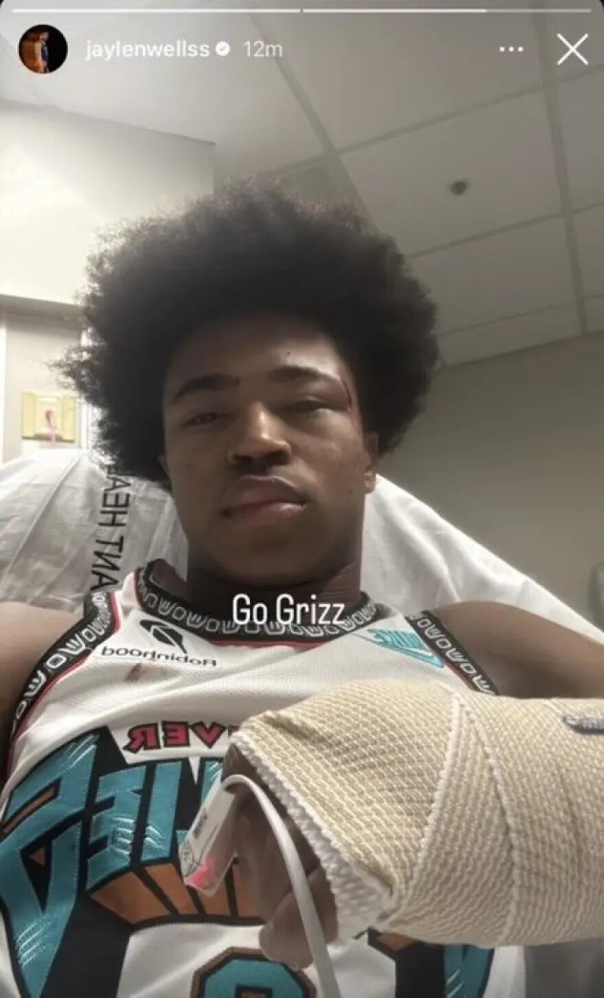 Το φάουλ που έκανε όλο το ΝΒΑ να προσευχηθεί: Ο Τζέιλεν Γουέλς παραλίγο να σπάσει τον λαιμό του από μια άγρια ​​πτώση - Βίντεο