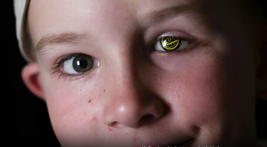 Champions League: Η υπόκλιση των οπαδών της Μπόντο Γκλίμτ στον 9χρονο Φρέντρικ