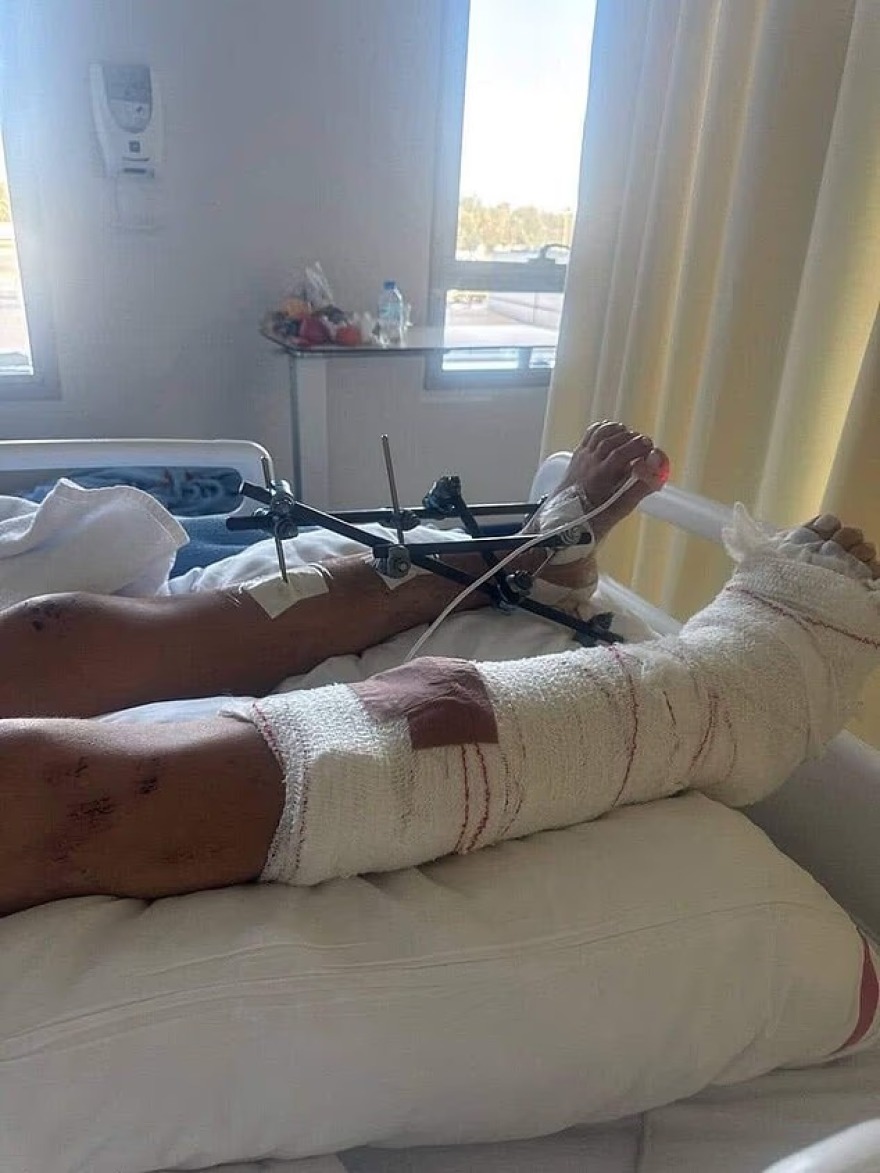 «Δεν μπορούσα να πω ούτε το όνομά μου, με αναγνώρισαν από ένα τατουάζ»: Η Ουκρανή που ξυλοκοπήθηκε στο Ντουμπάι μιλάει για τη ζωή της μετά από 10 χειρουργεία 