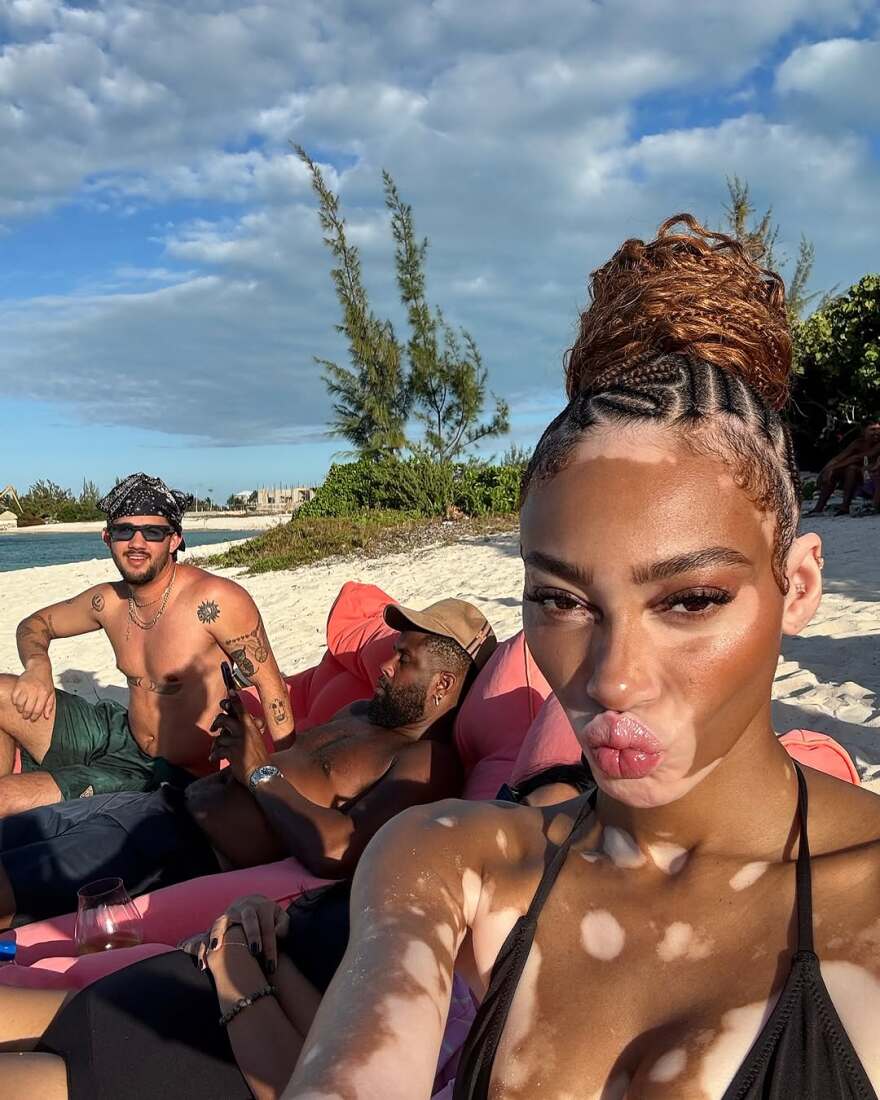 Η Γουίνι Χάρλοου είπε το μεγάλο «ναι» στον σύντροφό της, Κάιλ Κούζμα - Η πρόταση γάμου στο ιδιωτικό τζετ και το μονόπετρο δαχτυλίδι