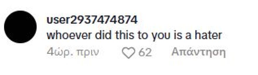 Η Έμιλι Ραταϊκόφσκι έχει πάθει σοκ με το νέο της κούρεμα - «Μοιάζεις με τον Λίαμ Γκάλαχερ», της γράφουν στα σχόλια