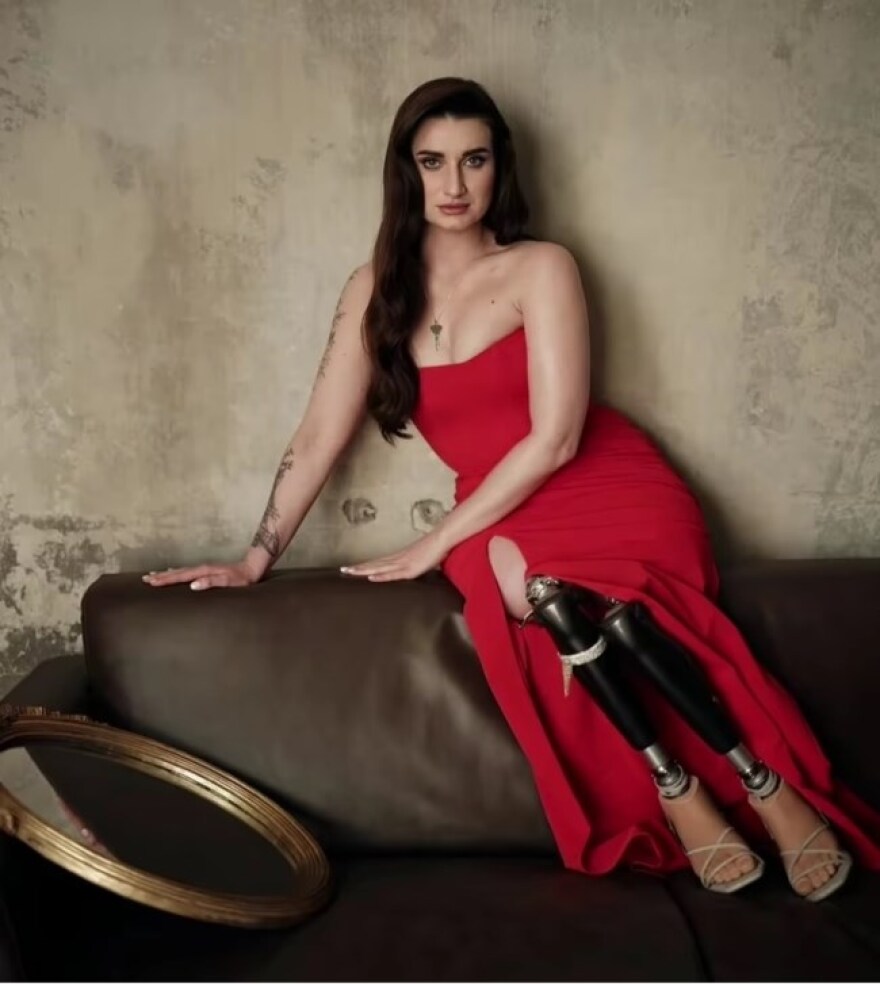 Ουκρανία: Το Playboy κάνει αφιέρωμα στις τραυματισμένες γυναίκες του πολέμου – Δείτε φωτογραφίες Ουκρανία: Το Playboy κάνει αφιέρωμα στις τραυματισμένες γυναίκες του πολέμου – Δείτε φωτογραφίες