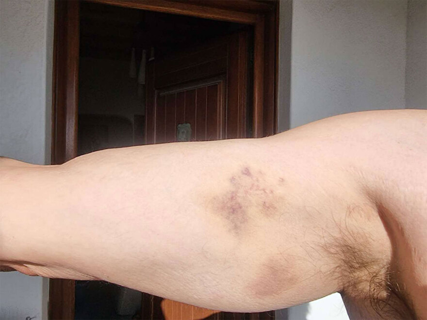 Επιχειρηματίας στη Μύκονο καταγγέλλει ξυλοδαρμό από αστυνομικούς – Τι απαντά η ΕΛΑΣ 5 Επιχειρηματίας στη Μύκονο καταγγέλλει ξυλοδαρμό από αστυνομικούς - Τι απαντά η ΕΛΑΣ