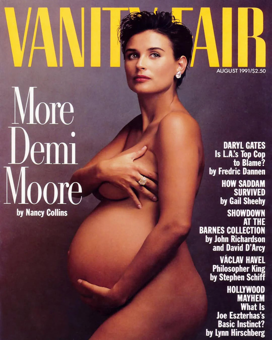 Carter Graydon, ο ζωντανός θρύλος των glossy περιοδικών 
