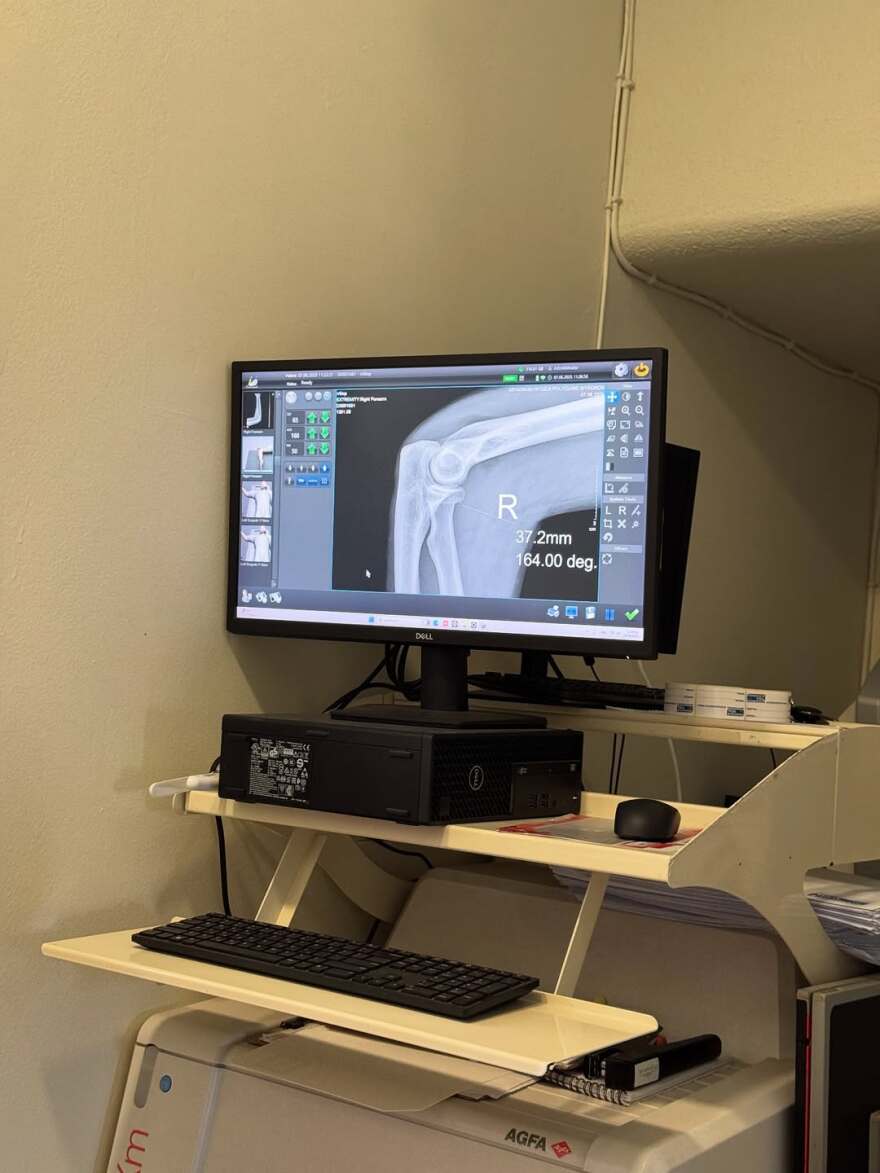 Δώρα Παντέλη: Ατύχημα για την εγκυμονούσα - «Το μωράκι μου και εγώ είμαστε καλά»
