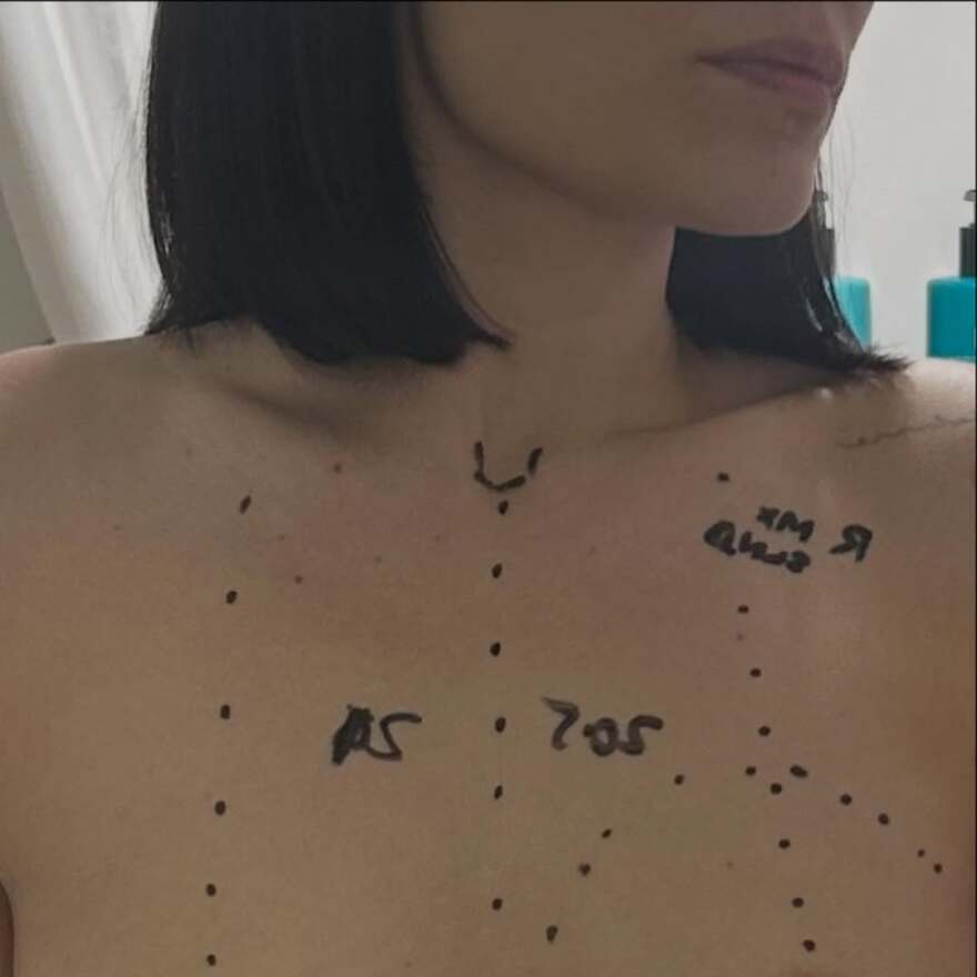 Η Jessie J υποβλήθηκε σε χειρουργική επέμβαση για τον καρκίνο του μαστού - Τα βίντεο και οι φωτογραφίες μέσα από το νοσοκομείο