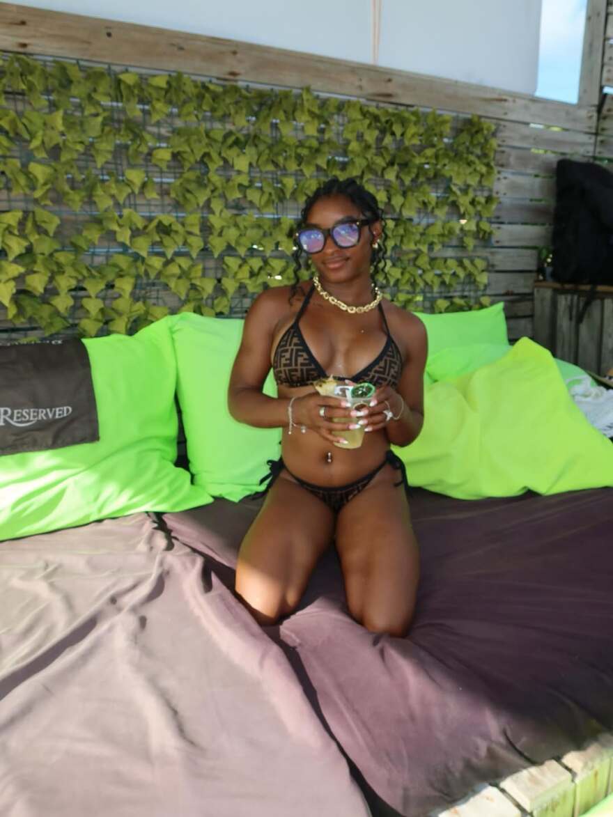 Σιμόν Μπάιλς: Η νέα ανάρτηση στο Instagram που «επιβεβαίωσε» ότι έκανε ενισχυτική επέμβαση στο στήθος της