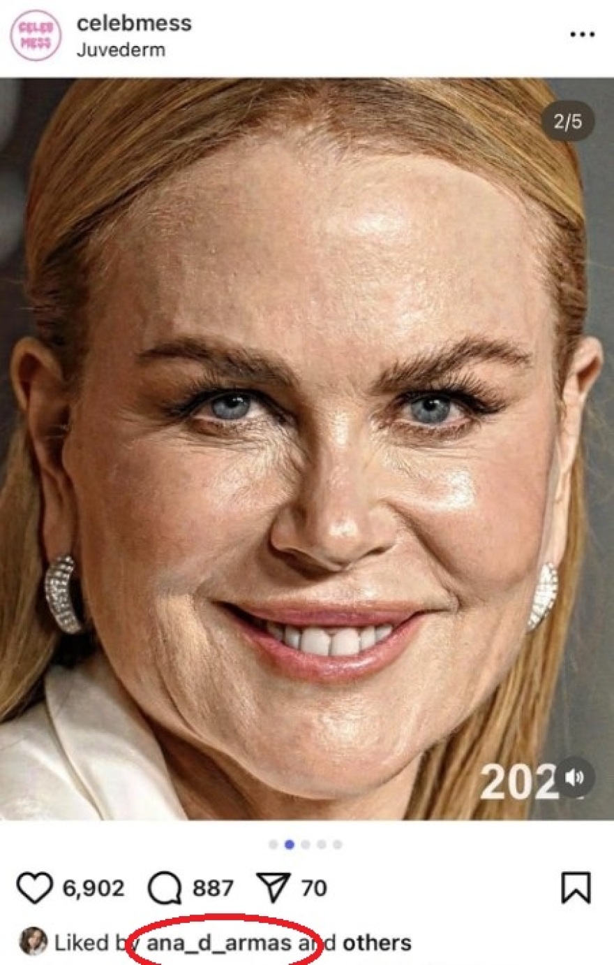 Η Άνα ντε Άρμας έκανε like σε ανάρτηση που ειρωνεύεται την εμφάνιση της Νικόλ Κίντμαν - «Ας τη δούμε στα 60» σχολιάζουν οι φαν της ηθοποιού