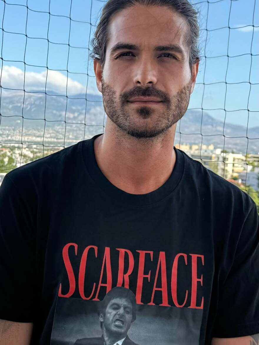 Ο Άρης Μουγκοπέτρος έκανε νέο χειρουργείο στο χέρι του - «Μετά από τέσσερις μήνες είμαι και πάλι στο ίδιο δωμάτιο»