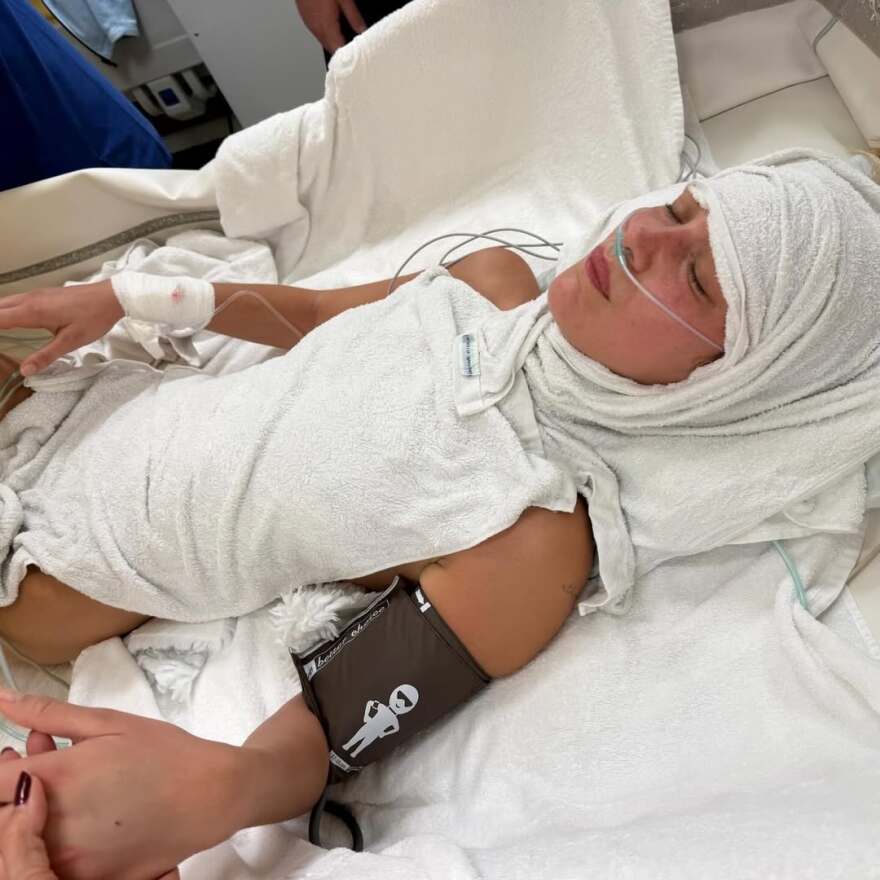 Φωτογραφίες: Η συγκλονιστική, γεμάτη πόνο μάχη της Μπέλα Χαντίντ με τη νόσο του Lyme - Έμαθες να ζεις στη φυλακή του παράλυτου μυαλού σου, γράφει η μητέρα της