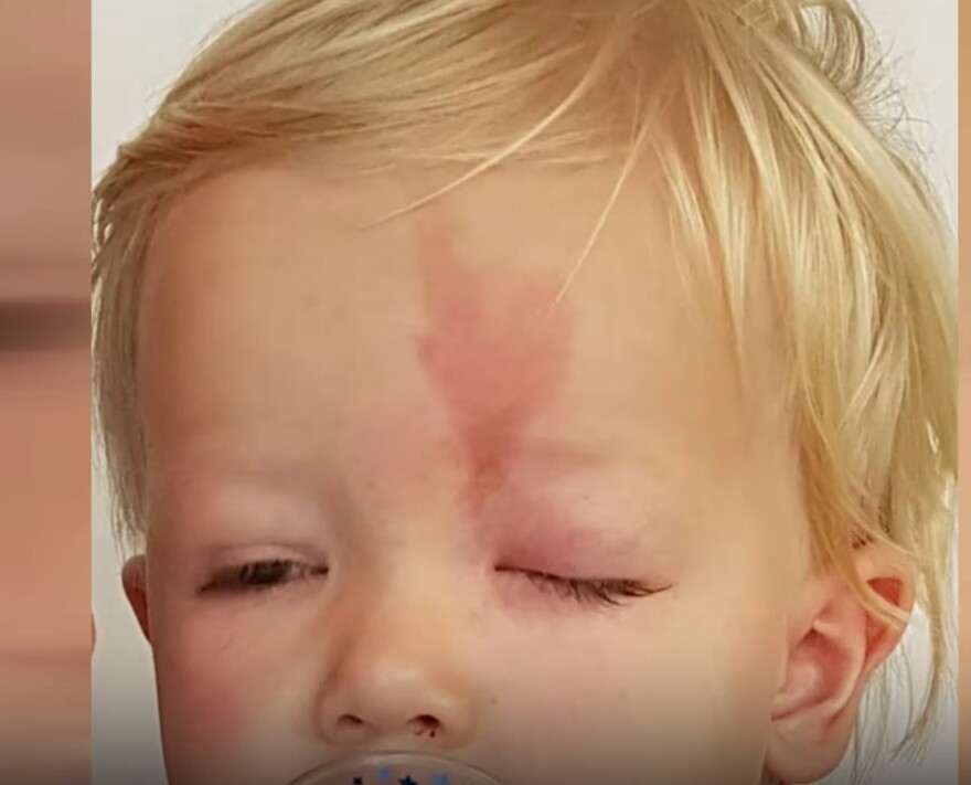 Champions League: Η υπόκλιση των οπαδών της Μπόντο Γκλίμτ στον 9χρονο Φρέντρικ