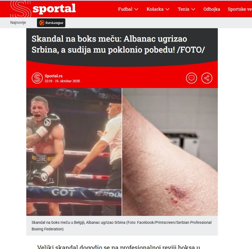 Αλβανός πυγμάχος δάγκωσε Σέρβο αντίπαλο του, αλλά κέρδισε τον αγώνα