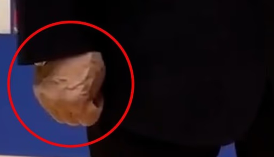 Νέες θεωρίες για την υγεία του Πούτιν - Οι διογκωμένες φλέβες στη διάρκεια χειραψίας, δείτε βίντεο