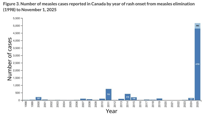 Η ιλαρά «επέστρεψε» στον Καναδά - Χιλιάδες κρούσματα και δύο νεκρά βρέφη, καθώς εμβολιάζεται όλο και λιγότερος κόσμος