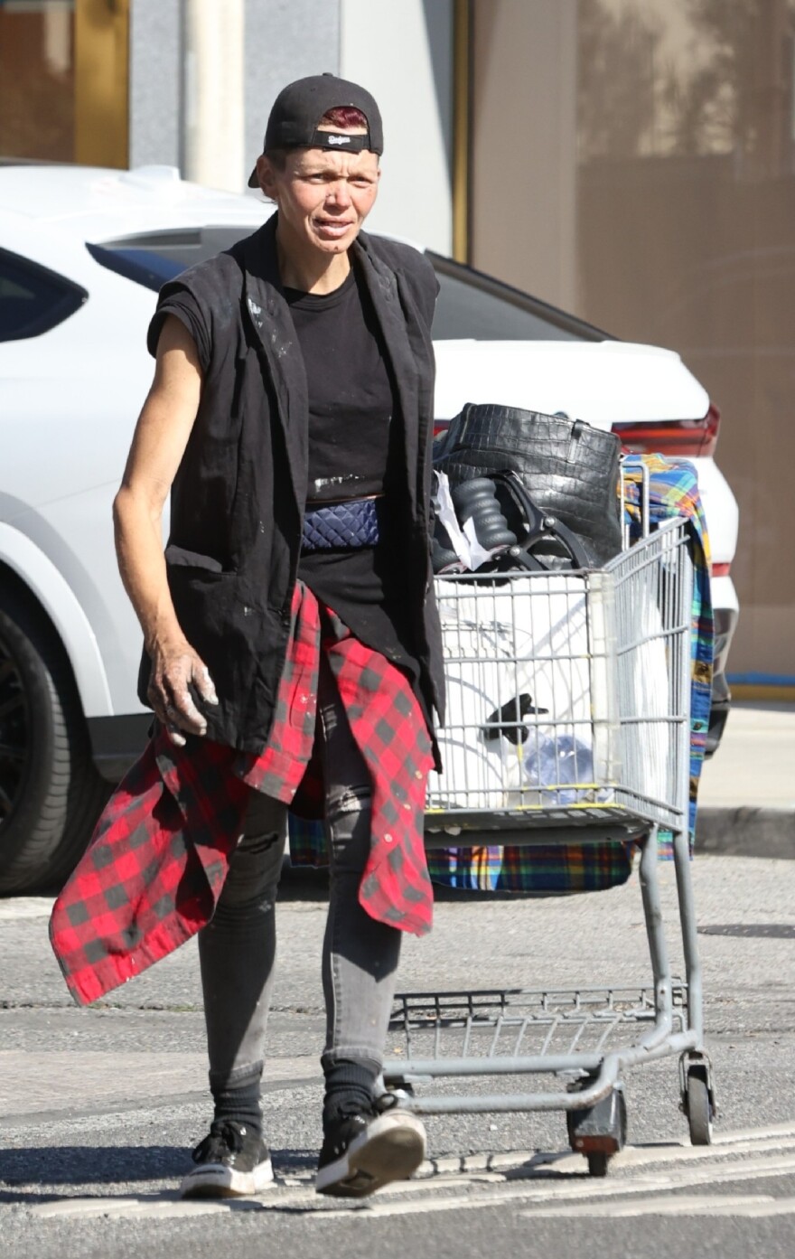 Η τραγική ιστορία της Λόνι Γουίλισον: Από διάσημο μοντέλο με μεγάλη περιουσία, άστεγη στους δρόμους να τρώει από τα σκουπίδια