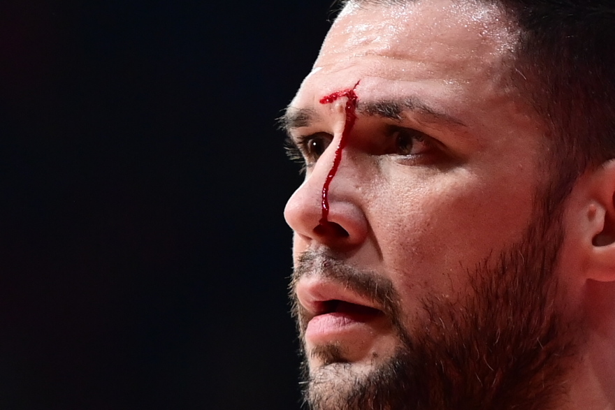 Μετά από αγκωνιά του Βοτιέ ο Παπανικολάου αποχώρησε για τα αποδυτήρια με αίματα στο μέτωπο, δείτε βίντεο και φωτογραφίες