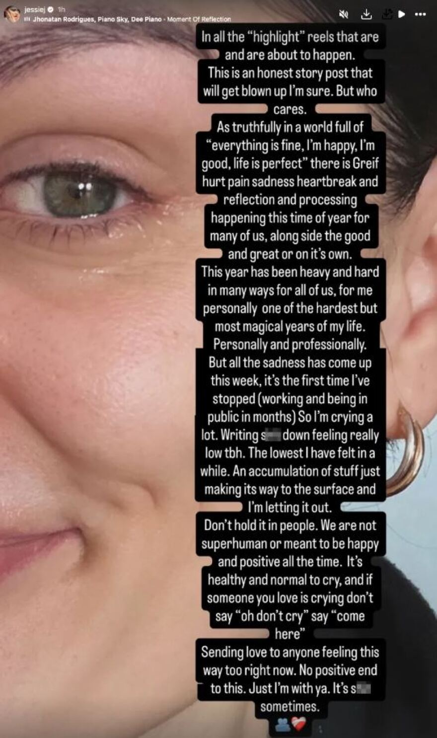 Jessie J: Νιώθω ότι βρίσκομαι πολύ «χαμηλά», όλη η λύπη έχει αναδυθεί, εξομολογήθηκε για τη μάχη με τον καρκίνο του μαστού
