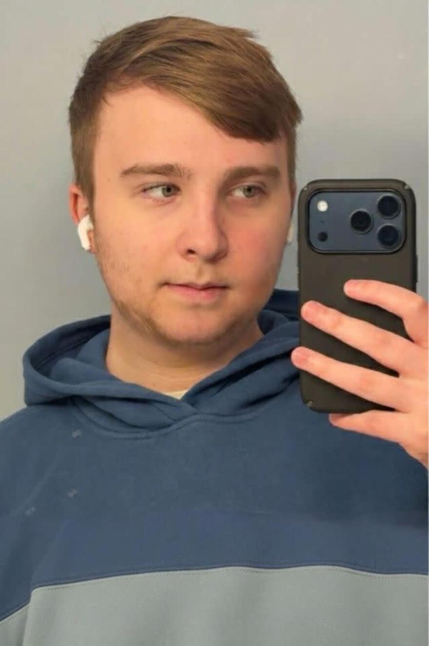 Ο άνθρωπος που υποβλήθηκε σε διπλή επέμβαση γνάθου: Η μεγάλη αλλαγή στην εμφάνισή του